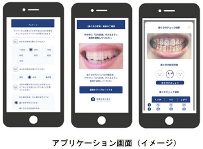 ライオン、熊本県合志市で口腔チェックアプリ活用した取り組みを実施