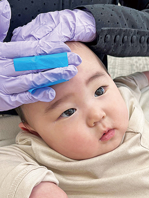 花王、乳幼児アトピー早期発見診断技術を開発　皮脂ＲＮＡモニタリングで